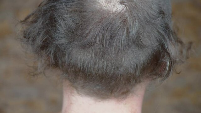 Man Gets hair Cut with Hair Clipper After Quarantine During Coronavirus Pandemic. Close up View on Head. Stop motion Shot