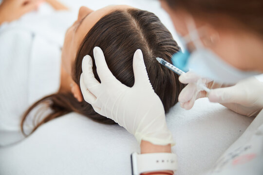 Dermatologist Injecting The Serum Into The Female Scalp