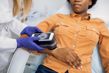 Preventive checkup, skin melanoma days concept. Close up of hands of female doctor dermatologist...