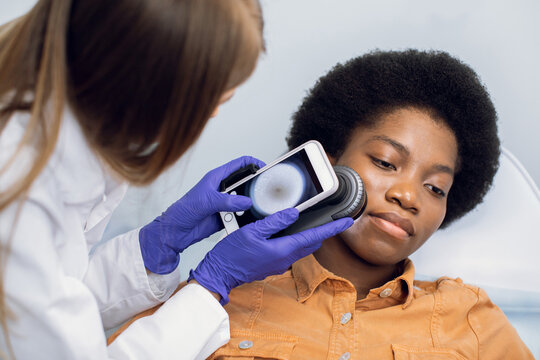 Close up of hands of female doctor holding dermatoscope for study of moles, birthmarks, warts, checking her patient's face. Beautiful afro american woman lying on the couch