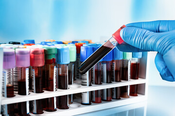 Technician working with tray blood tubes samples for testing in the preanalytical lab. rack with...