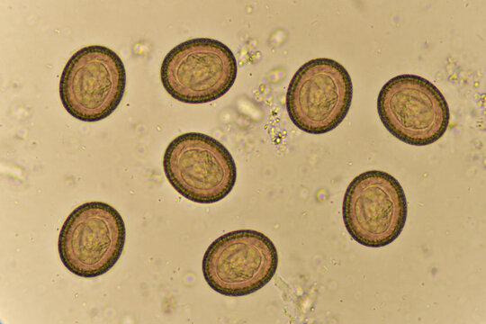 Egg of Taenia or tapeworm in human stool, analyze by microscope ...