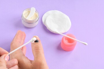 Injured finger on the hand with a hematoma under the nail on purple background with ointment and...