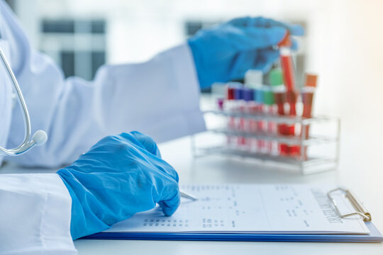 The doctor hand records the blood test examination results and medication usage of the patient on the chart, medical check-up concept