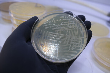 growth of bacterial colonies on agar media in a plastic plate