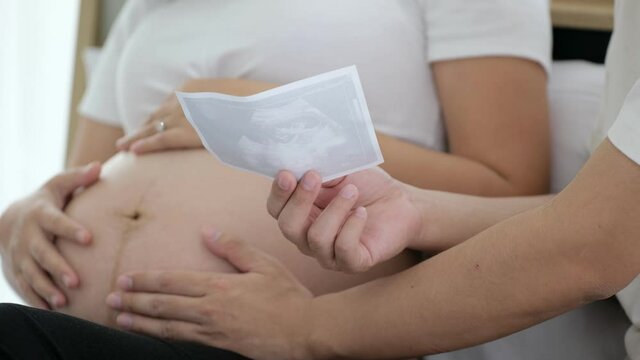 Asian man and pregnant woman looking at ultrasound film picture sideway in white shirt and background