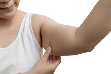 Concept of cosmetic surgery for removing excess fat and cellulite from under the skin,young female is touching her large arms,showing the sagging layer of fat from her upper arm from shoulder to elbow
