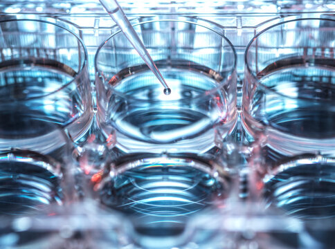 Petri dish and pipette