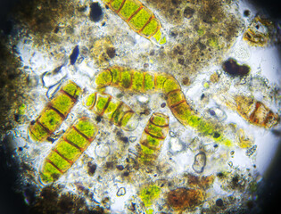 Microalgae under a microscope, sample taken from moss
