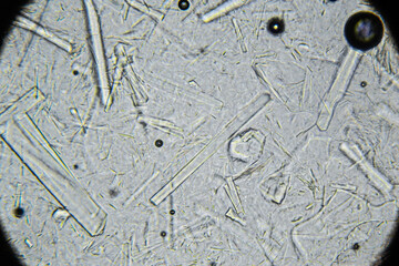Artificial honey with large rectangular sugar crystals under microscope. Natural honey mixed with sugar syrup. Low pollen count. Poor quality food product