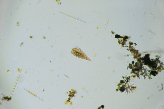 Ciliates Stentor found in freshwater pond under the light microscope