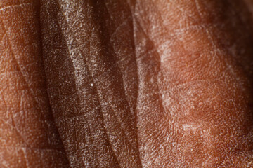 Close up skin texture with wrinkles on body human