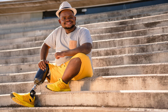 portrait of black man with prosthetic leg .
