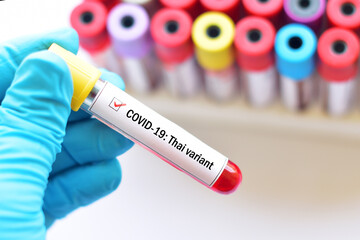 Obraz premium Thai variant of COVID-19, blood sample tube positive with Thai strain of COVID-19 virus 