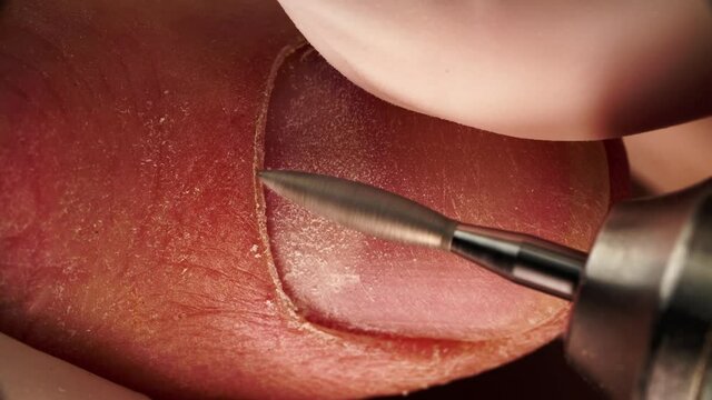 Macro view of removing cuticle and polishing finger nail by electric drill filmed from above. Theme of making apparatus manicure by professional sterile equipment in salon. Beauty and fashion industry