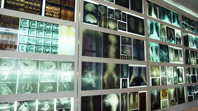 Wall with multiple MRI photos. Many x-ray photographs showing people's bones. MRI images including: head, neck, arm, foot, pelvis.