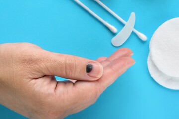 Injured finger on the hand with a hematoma under the nail on blue background with ointment and...