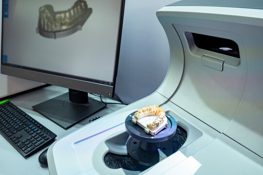 Scanner for creating three-dimensional image of prostheses. 3D scanner and monitor in orthodontist office. Production of dental crowns. Dentistry scanner. Sale of modern dental equipment.