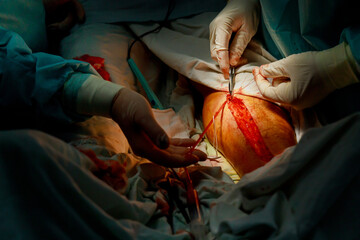 Surgeons team working with leg of patient in operating room