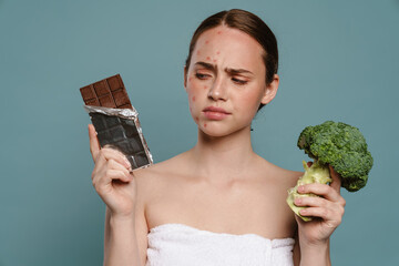 Ginger woman with pimples posing with chocolate and broccoli