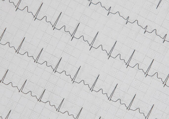 a cardiac EKG printed on paper
