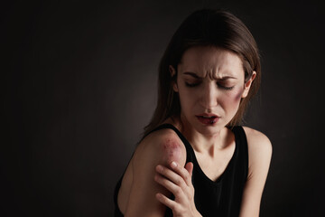 Obraz premium Woman with facial injuries on black background, space for text. Domestic violence victim