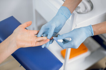 Close up of nurse lab technician in blue sterile gloves, using painless scarifier to prick the finger of unrecognizable patient, sitting on chair. Blood analysis and group determination - obrazy, fototapety, plakaty