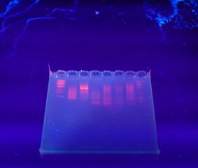 DNA bands on agarose gel plate