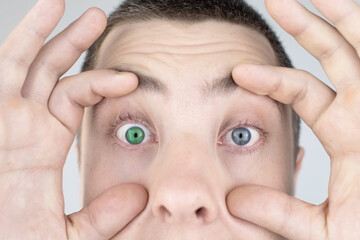 A man with different color eyes looks into the frame. The right eye is blue and the left is green....
