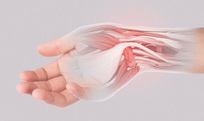 x-ray wrist muscle pain
