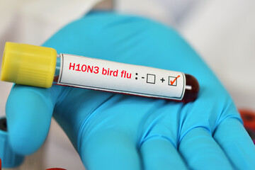 Obraz premium H10N3 bird flu positive, blood sample tube positive with influenza A virus subtype H10N3