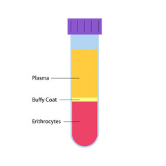 Platelet rich plasma concept