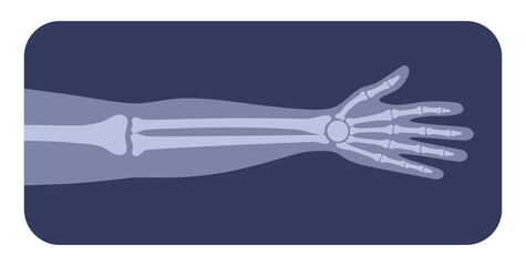 Arm bones poster