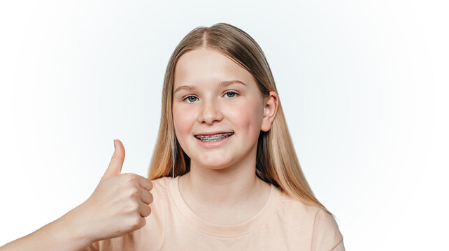 Smiling blonde girl with orthodontic braces holding her thumb up, orthodontic treatment of misaligned or crooked teeth