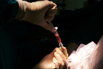 Neurosurgeon drawing pus from brain abscess