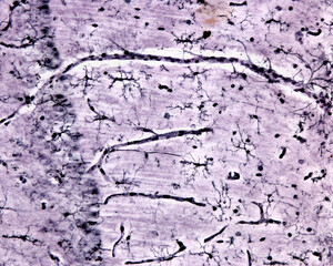 Microglia. Rio-Hortega's silver carbonate