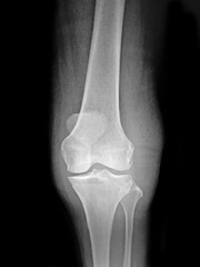 x ray image of joint