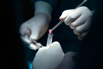 concentrated professional surgical doctor team operating surgery a patient in the operating room at hospital. tumor cancer. surgical biopsy specimens. healthcare and medical concept.