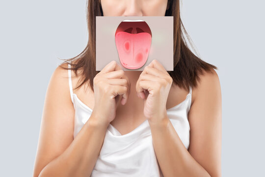 The woman show the picture of tongue problems