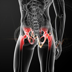 3d rendered, medical illustration of a painful hip joint - back view