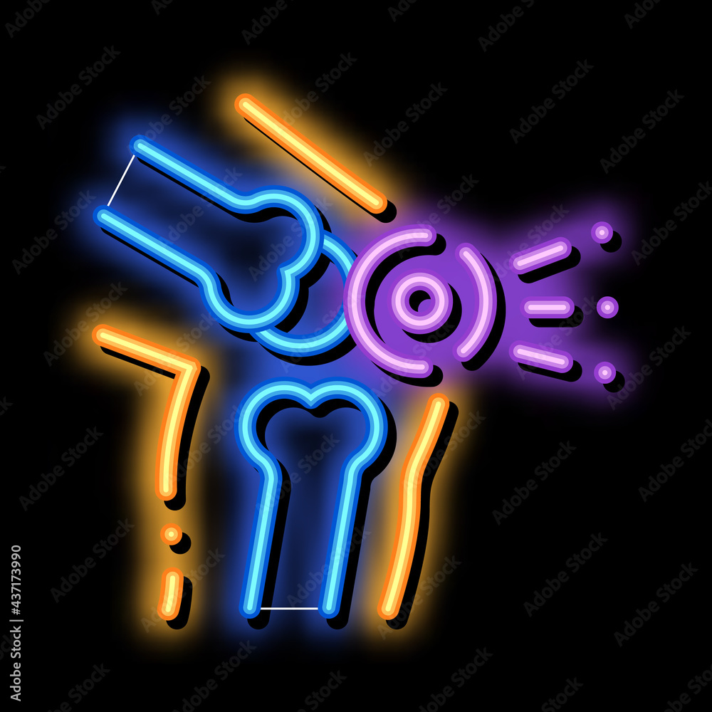 Wall mural Knee Pain Leg Bones Orthopedic Element neon light sign vector. Glowing bright icon transparent symbol illustration