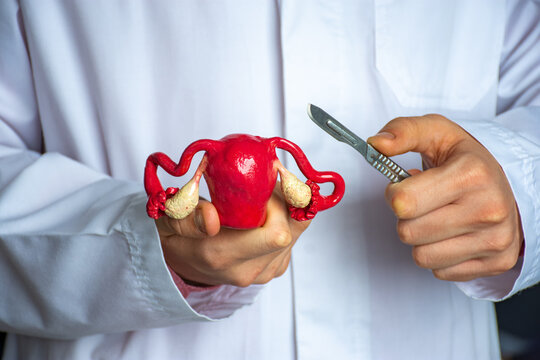 Gynecological surgery for women concept photo. Gynecologist surgeon holds model of uterus with ovaries in his hand and scalpel in other hand. Concept photo of operation on female reproductive organs