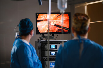 Monitor depicting endoscopic surgery. Endoscopic camera - 437255334