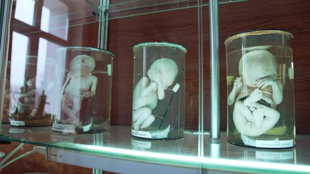 Fetus in formalin solution in museum. Human organs in jars with formalin in anatomical museum