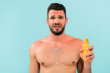 Tensed man with sunburn holding sunscreen isolated on blue - Powered by Adobe