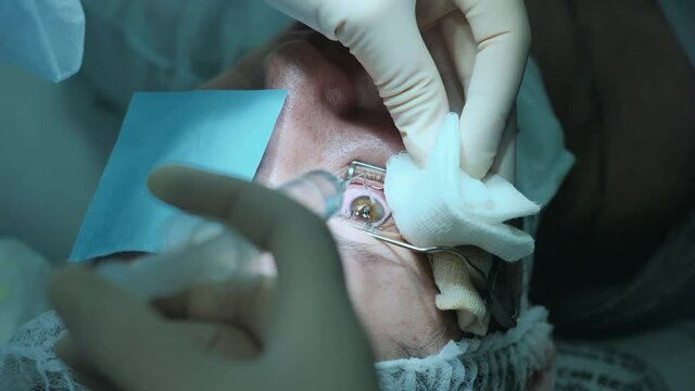Person's eye is getting anaesthetized with liquid