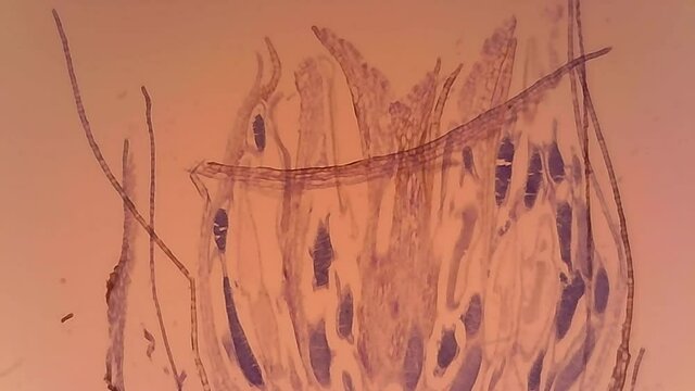 Microscope Polytrichum Archegonia Longitudinal Section x1200