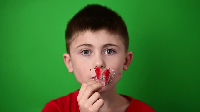 A 9-year-old boy is holding a dental alignment plate, an abomination and a demonstration of a dental alignment plate.