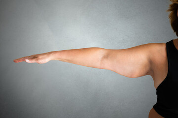 Overweight Lady Arm With Excess Fat