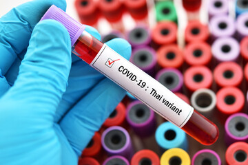 Obraz premium Thai variant of COVID-19, blood sample tube positive with Thai strain of COVID-19 virus